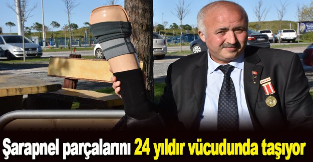 Şarapnel parçalarını 24 yıldır vücudunda taşıyor