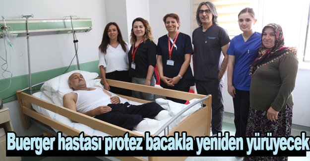 Samsun'da Buerger hastası protez bacakla yeniden yürüyecek